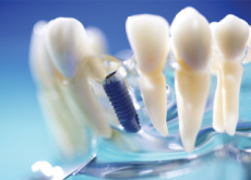 A Wireless Tooth Sensor - Science